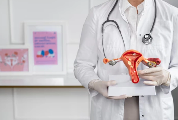 PCOS Management