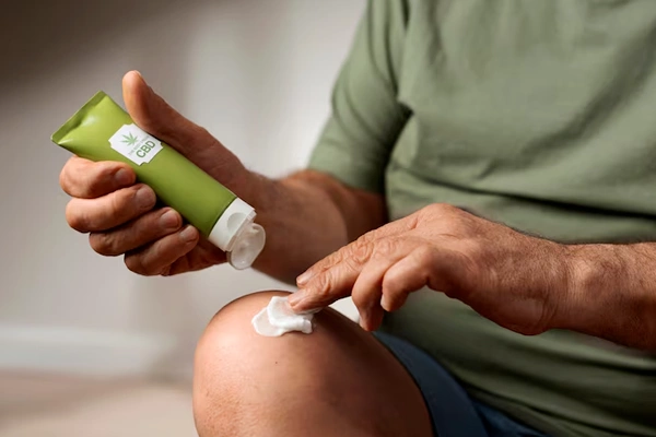 Burn treatment